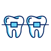 Dental Braces in Jaipur